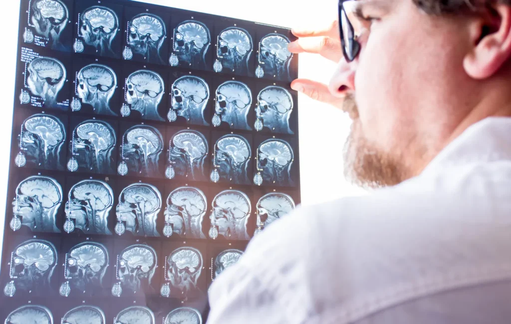 Brain Injury Attorneys in Colorado Springs | Call 719-520-9909